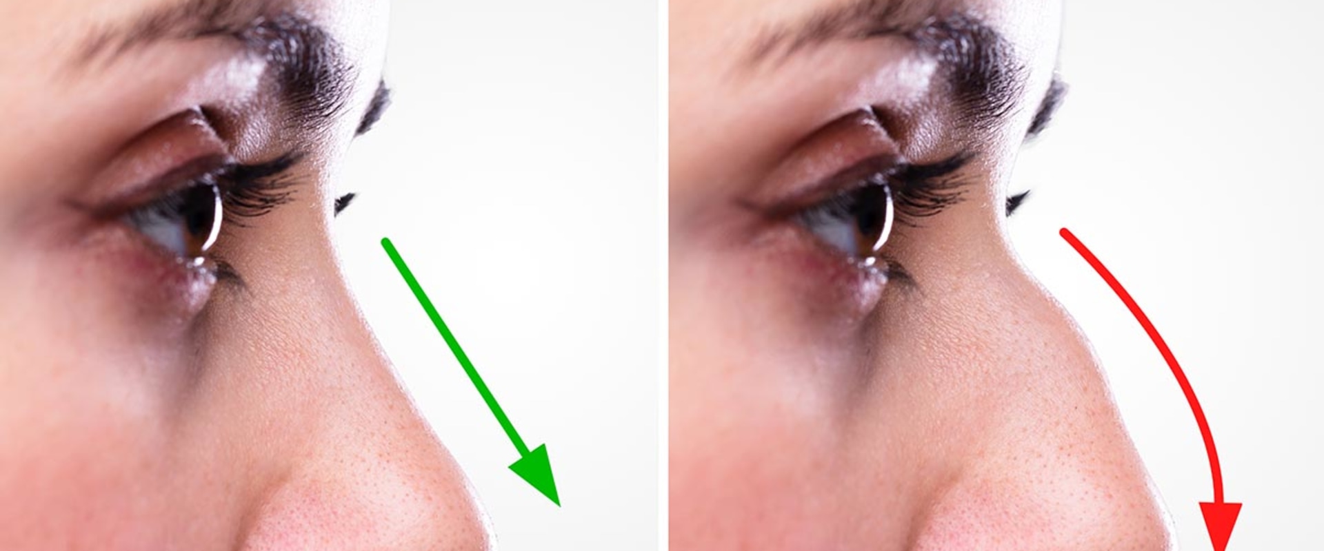 The Ultimate Guide to Choosing the Perfect Nose Job for Your Face